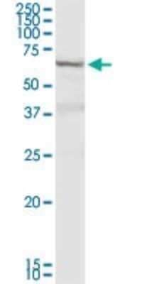 Western Blot: DTX2 Antibody [H00113878-D01P] - Analysis of DTX2 expression in human stomach.