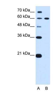 Western Blot: DTX2 Antibody [NBP1-53119] - HepG2 cell lysate, concentration 0.2-1 ug/ml.