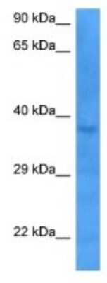 Western Blot: DTX3 Antibody [NBP3-10787] - Western blot analysis of DTX3 in 721_B Whole Cell lysates. Antibody dilution at 1ug/ml