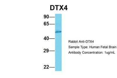 Western Blot DTX4 Antibody - BSA Free