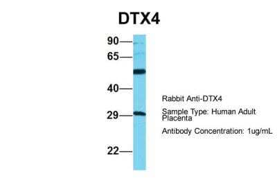 Western Blot DTX4 Antibody - BSA Free