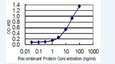 ELISA: DTYMK Antibody (2G11) [H00001841-M02-100ug] - Detection limit for recombinant GST tagged DTYMK is 0.3 ng/ml as a capture antibody.