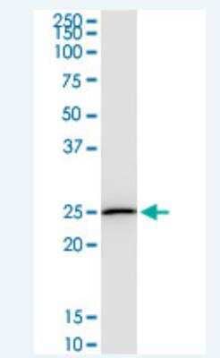 Western Blot: DTYMK Antibody (2G11) [H00001841-M02-100ug] - Analysis of DTYMK expression in HeLa.