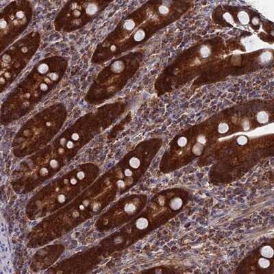 Immunohistochemistry-Paraffin: DTYMK Antibody [NBP1-91850] - Staining of human duodenum shows strong cytoplasmic positivity in glandular cells.