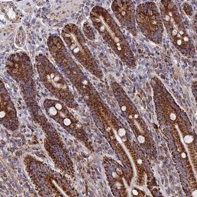 Immunohistochemistry-Paraffin: DTYMK Antibody [NBP1-91851] - Staining of human duodenum shows strong granular cytoplasmic positivity in glandular cells.