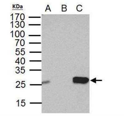 Immunoprecipitation: DTYMK Antibody [NBP2-16231] - IP Sample: HeLa whole cell lysate/extract A. 40 ug HeLa whole cell lysate/extract B. Control with 2 ug of preimmune rabbit IgG C. Immunoprecipitation of Thymidylate kinase protein by 2 ug of Thymidylate kinase antibody 10% SDS-PAGE The immunoprecipitated Thymidylate kinase protein was detected by Thymidylate kinase antibody diluted at 1:1000. EasyBlot anti-rabbit IgG was used as a secondary reagent.