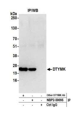Immunoprecipitation: DTYMK Antibody [NBP2-59095] - Detection of human DTYMK by western blot of immunoprecipitates. Samples: Whole cell lysate (0.5 or 1.0 mg per IP reaction; 20% of IP loaded) from 293T cells prepared using NETN lysis buffer. Antibodies: Affinity purified rabbit anti-DTYMK antibody NBP2-59095 used for IP at 20 ul per reaction. DTYMK was also immunoprecipitated by another rabbit anti-DTYMK antibody. For blotting immunoprecipitated DTYMK, NBP2-59095 was used at 1:100. Detection: Chemiluminescence with an exposure time of 10 seconds.