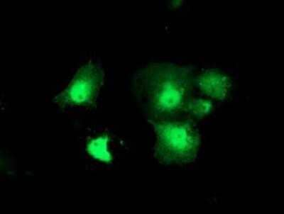 Immunocytochemistry/Immunofluorescence: DTYMK Antibody (OTI1G8) - Azide and BSA Free [NBP2-70604] - Staining of COS7 cells transiently transfected by pCMV6-ENTRY DTYMK.