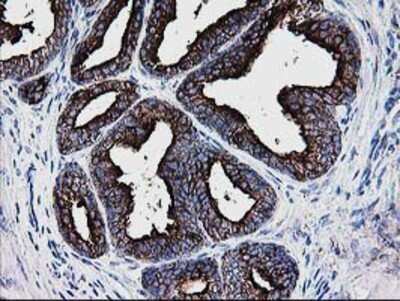 Immunohistochemistry: DTYMK Antibody (OTI1G8) - Azide and BSA Free [NBP2-70604] - Staining of paraffin-embedded Human prostate tissue using anti-DTYMK mouse monoclonal antibody.