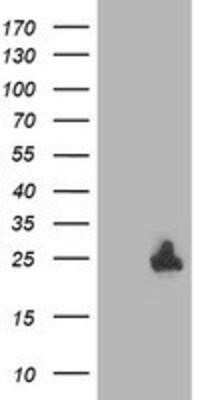 Western Blot: DTYMK Antibody (OTI1G8) - Azide and BSA Free [NBP2-70604] - HEK293T cells were transfected with the pCMV6-ENTRY control (Left lane) or pCMV6-ENTRY DTYMK (Right lane) cDNA for 48 hrs and lysed. Equivalent amounts of cell lysates (5 ug per lane) were separated by SDS-PAGE and immunoblotted with anti-DTYMK.