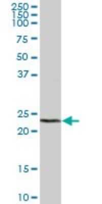 Western Blot: DTYMK Antibody [H00001841-B01P] - Analysis of DTYMK expression in human liver.