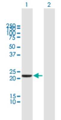 Western Blot: DTYMK Antibody [H00001841-B01P] - Analysis of DTYMK expression in transfected 293T cell line by DTYMK polyclonal antibody.  Lane 1: DTYMK transfected lysate(23.32 KDa). Lane 2: Non-transfected lysate.