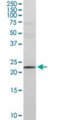 Western Blot: DTYMK Antibody [H00001841-D01P] - Analysis of DTYMK expression in HeLa.