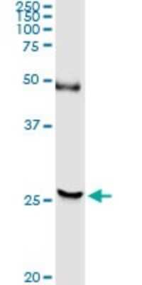 Western Blot: DTYMK Antibody [H00001841-D01P] - Analysis of DTYMK expression in human colon.