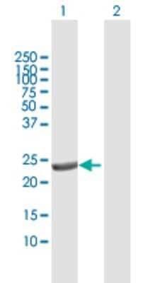 Western Blot: DTYMK Antibody [H00001841-D01P] - Analysis of DTYMK expression in transfected 293T cell line by DTYMK polyclonal antibody.Lane 1: DTYMK transfected lysate(23.80 KDa).Lane 2: Non-transfected lysate.