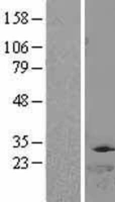 Western Blot: DTYMK Overexpression Lysate (Adult Normal) [NBL1-10039] Left-Empty vector transfected control cell lysate (HEK293 cell lysate); Right -Over-expression Lysate for DTYMK.