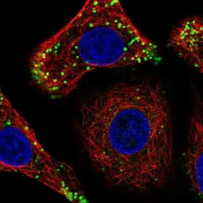 Immunocytochemistry/Immunofluorescence: DULLARD Antibody [NBP2-68840] - Staining of human cell line A549 shows localization to lipid droplets.