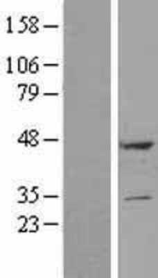 Western Blot: DULLARD Overexpression Lysate (Adult Normal) [NBL1-10040] Left-Empty vector transfected control cell lysate (HEK293 cell lysate); Right -Over-expression Lysate for DULLARD.