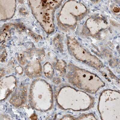 Immunohistochemistry-Paraffin: DUOX1 Antibody [NBP1-81301] - Staining of human thyroid gland shows moderate cytoplasmic positivity in glandular cells.