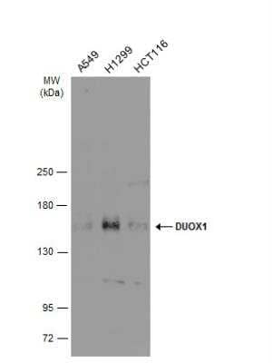 Western Blot: DUOX1 Antibody [NBP2-16232] - Various whole cell extracts (30 ug) were separated by 5% SDS-PAGE, and the membrane was blotted with DUOX1 antibody [N1N3] diluted at 1:500. The HRP-conjugated anti-rabbit IgG antibody (NBP2-19301) was used to detect the primary antibody.