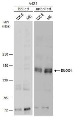 Western Blot: DUOX1 Antibody [NBP2-16232] - Boiled and unboiled A431 whole cell and membrane extracts (30 ug) were separated by 5% SDS-PAGE, and the membrane was blotted with DUOX1 antibody [N1N3]  diluted at 1:1000. The HRP-conjugated anti-rabbit IgG antibody (NBP2-19301) was used to detect the primary antibody. (WCE: whole cell extract; ME: membrane extract). 