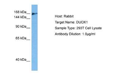 Western Blot: DUOX1 Antibody [NBP2-87306] - Host: Rabbit. Target Name: DUOX1. Sample Tissue: Human 293T Whole Cell lysates. Antibody Dilution: 1ug/ml