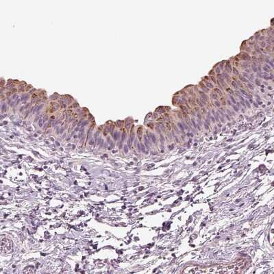 Immunohistochemistry-Paraffin: DUOXA2 Antibody [NBP2-57547] - Staining of human urinary bladder shows strong granular cytoplasmic positivity in urothelial cells.