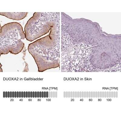 Immunohistochemistry-Paraffin: DUOXA2 Antibody [NBP2-57547] - Analysis in human gallbladder and skin tissues using NBP2-57547 antibody. Corresponding DUOXA2 RNA-seq data are presented for the same tissues.