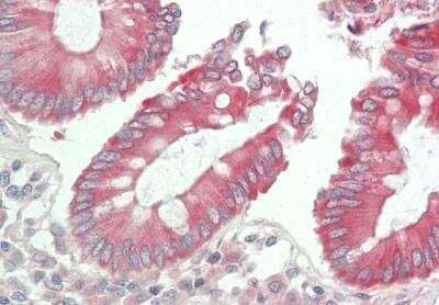 Immunohistochemistry-Paraffin: DUOXA2 Antibody [NBP2-82936] - Rabbit Anti-DUOXA2 antibody. Formalin Fixed Paraffin Embedded Tissue: Human Colon. Primary antibody Concentration: 1:100. Secondary Antibody: Donkey anti-Rabbit-Cy3. Secondary Antibody Concentration: 1:200. Magnification: 20x. Exposure Time: 0.5-2.0sec