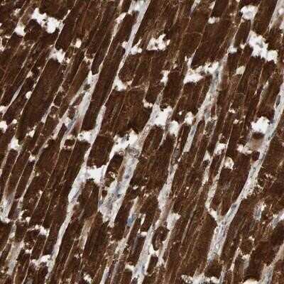 Immunohistochemistry-Paraffin: DUS1L Antibody [NBP1-84962] - Staining of human heart muscle shows strong cytoplasmic positivity in myocytes.