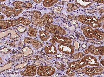 Immunohistochemistry-Paraffin: DUS1L Antibody [NBP3-06506] - Staining of human DUS1L in human kidney with rabbit polyclonal antibody at 1:100 dilution.