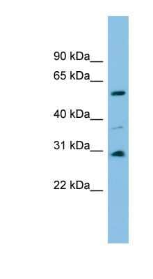 Western Blot: DUS1L Antibody [NBP1-57742] - Human Brain lysate, concentration 0.2-1 ug/ml.