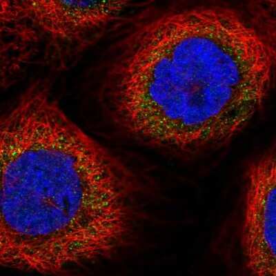 Immunocytochemistry/Immunofluorescence: DUS2L Antibody [NBP1-91853] - Immunofluorescent staining of human cell line A-431 shows localization to cytosol.