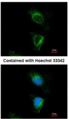 Immunocytochemistry/Immunofluorescence: DUS2L Antibody [NBP2-16234] - Analysis of methanol-fixed HeLa, using antibody at 1:500 dilution.