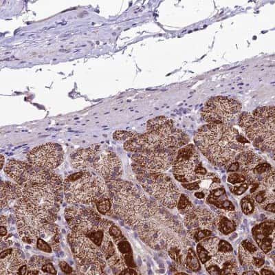 Immunohistochemistry-Paraffin: DUS2L Antibody [NBP1-91852] - Staining of human stomach shows strong cytoplasmic positivity in glandular cells.