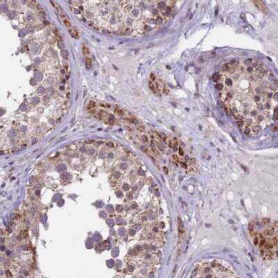 Immunohistochemistry-Paraffin DUS2L Antibody - BSA Free