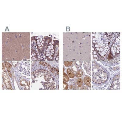 Immunohistochemistry-Paraffin DUS2L Antibody - BSA Free