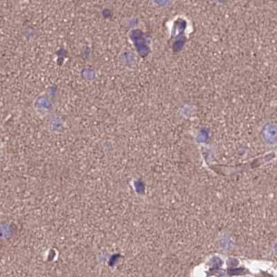 Immunohistochemistry-Paraffin: DUS2L Antibody [NBP1-91852] - Staining of human cerebral cortex.