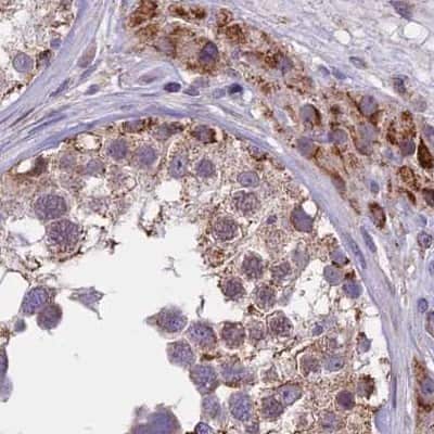 Immunohistochemistry-Paraffin: DUS2L Antibody [NBP1-91852] - Staining of human testis.