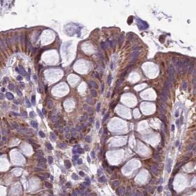Immunohistochemistry-Paraffin: DUS2L Antibody [NBP1-91852] - Staining of human colon.