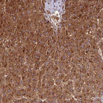 Immunohistochemistry-Paraffin: DUS2L Antibody [NBP1-91853] - Staining of human liver shows strong cytoplasmic positivity in hepatocytes.