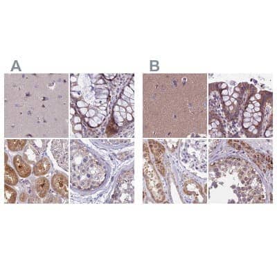 <b>Independent Antibodies Validation. </b>Immunohistochemistry-Paraffin: DUS2L Antibody [NBP1-91853] - Staining of human cerebral cortex, colon, kidney and testis using Anti-DUS2 antibody NBP1-91853 (A) shows similar protein distribution across tissues to independent antibody NBP1-91852 (B).