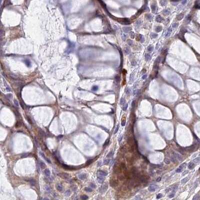 Immunohistochemistry-Paraffin: DUS2L Antibody [NBP1-91853] - Staining of human colon.