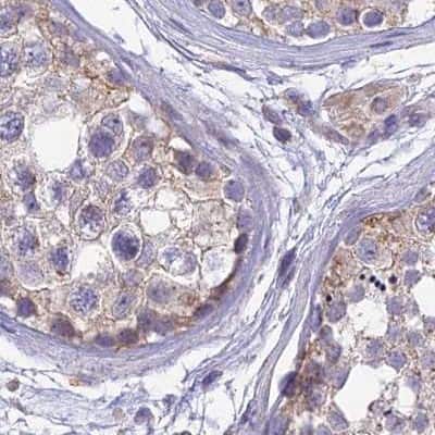 Immunohistochemistry-Paraffin: DUS2L Antibody [NBP1-91853] - Staining of human testis.