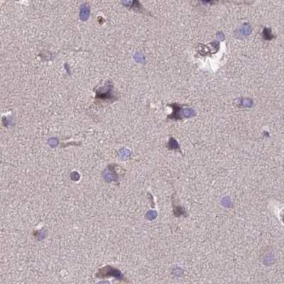 Immunohistochemistry-Paraffin: DUS2L Antibody [NBP1-91853] - Staining of human cerebral cortex.