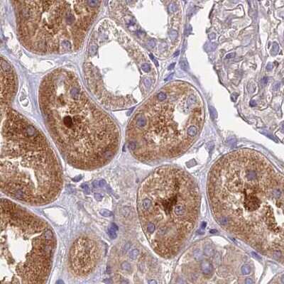 Immunohistochemistry-Paraffin: DUS2L Antibody [NBP1-91853] - Staining of human kidney.