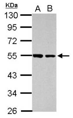 Western Blot: DUS2L Antibody [NBP2-16233] - Sample (30 ug of whole cell lysate) A: HeLa B: HepG2 10% SDS PAGE gel, diluted at 1:1000.