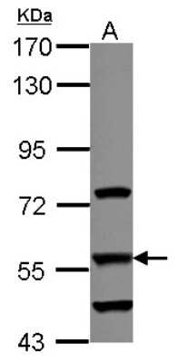 Western Blot: DUS2L Antibody [NBP2-16234] - Sample (30 ug of whole cell lysate) A: A549 7. 5% SDS PAGE gel, diluted at 1:1000.