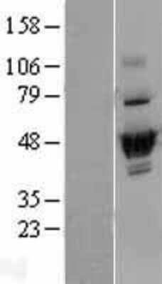 Western Blot: DUS2L Overexpression Lysate (Adult Normal) [NBP2-04364] Left-Empty vector transfected control cell lysate (HEK293 cell lysate); Right -Over-expression Lysate for DUS2L.