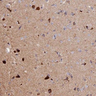Immunohistochemistry-Paraffin: DUS3L Antibody [NBP1-84042] - Staining of human cerebral cortex shows strong cytoplasmic positivity in neuronal cells.